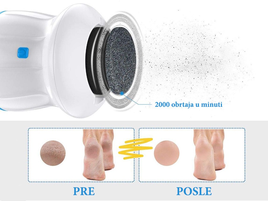 uređaj za suve i napukle pete
