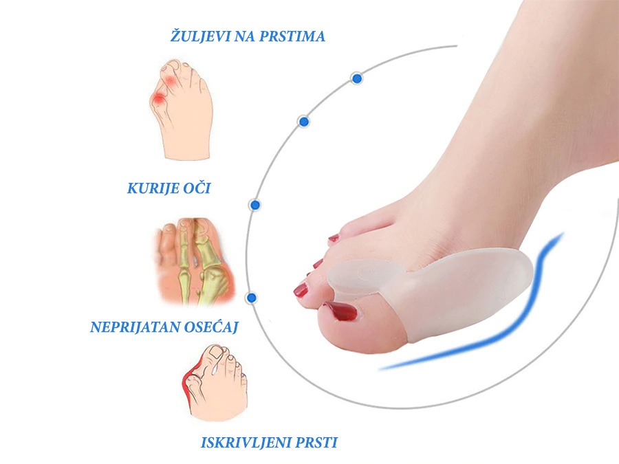 Separatori za čukljeve od silikona