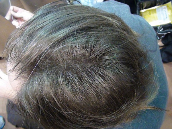 REVOLUMEN HAIR vlakna za proređenu kosu REVOLUMEN HAIR vlakna za proređenu kosu