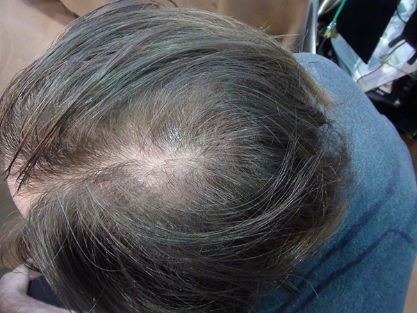 REVOLUMEN HAIR vlakna za proređenu kosu REVOLUMEN HAIR vlakna za proređenu kosu